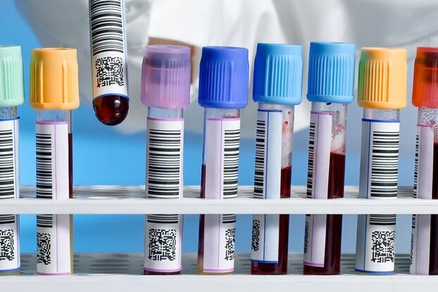 Mehrere Laborröhrchen mit Barcode Etiketten, im Tray, Bildmotiv für Rundverklebung, Querformat